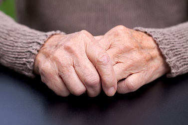 Artrosis: Remedios Caseros y Recomendaciones para Aliviar la Enfermedad