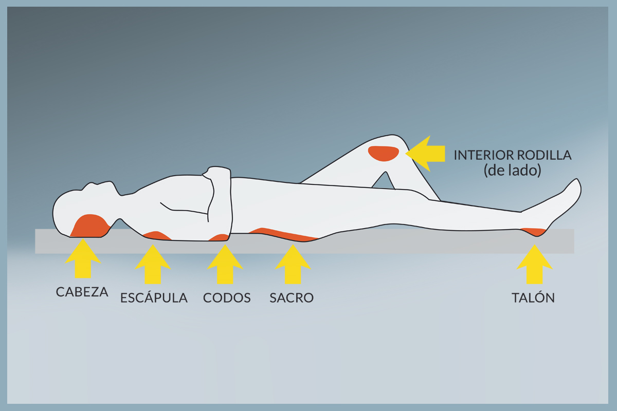 Prevención es Fundamental