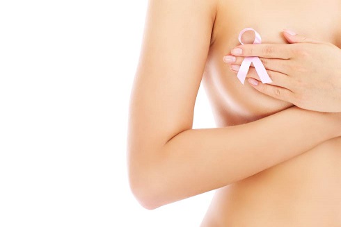 Cáncer de Mama