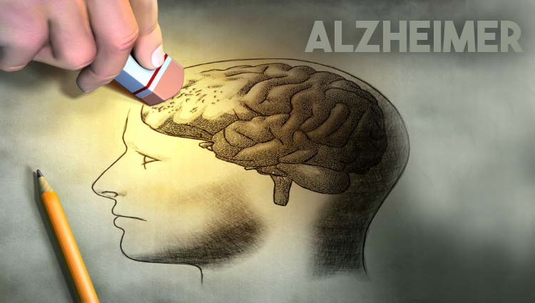 alzhéimer