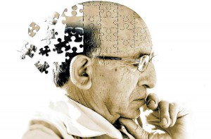 alzheimer