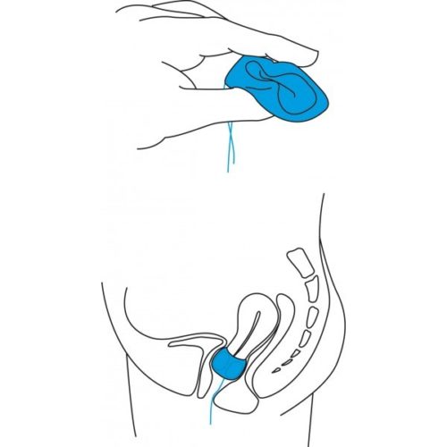 esario Cúbico GIN & CUBE. Tratamiento del prolapso de las paredes vaginales y el útero.