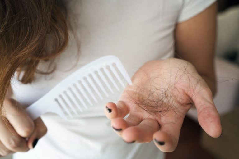 caida de pelo en mujer